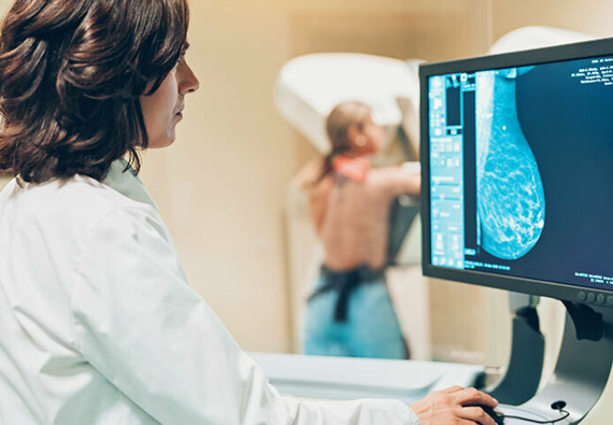 Breast cancer mammogram screening